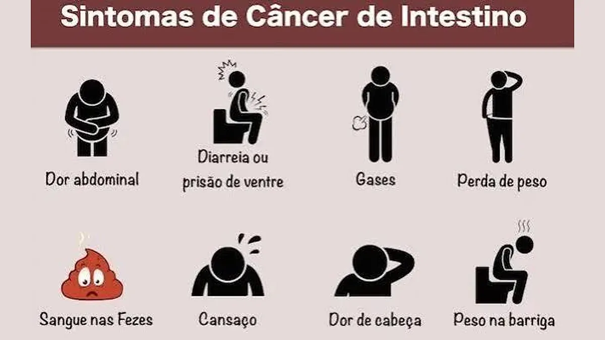 Câncer de intestino: sintomas, prevenção e o alerta após a morte de Lua Blanco